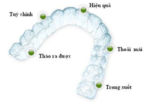 Chỉnh nha bằng Invisalign